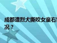 成都遭烈犬撕咬女童右肾已保住，恢复情况良好 这是什么情况？