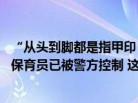 “从头到脚都是指甲印！”家长称3岁男童在幼儿园被虐待，保育员已被警方控制 这是什么情况？