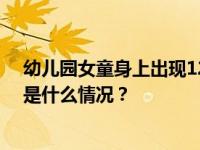 幼儿园女童身上出现12个针眼，呼和浩特警方介入调查 这是什么情况？