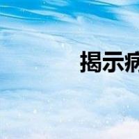 揭示病毒支架构建背后的规则